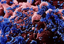 H5N1 Avian Influenza Virus